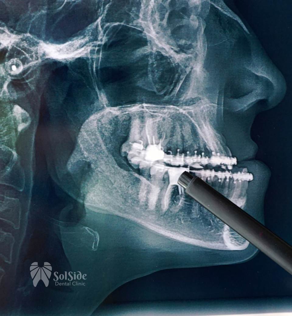 Sol Side Dental Clinic